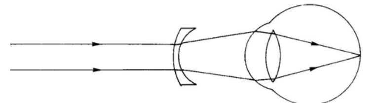 Question figure
