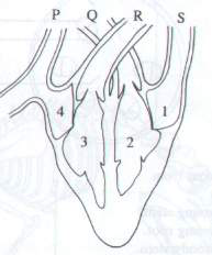 Question figure