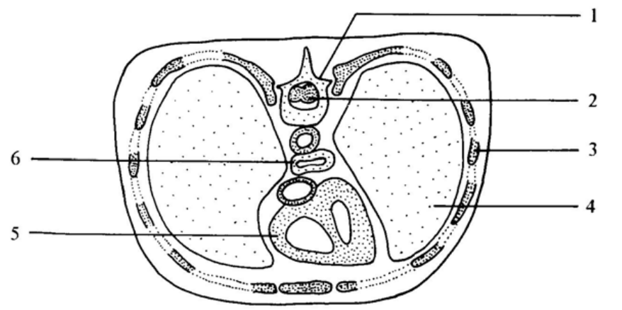 Transverse section of the human thorax with structures 1 to 6 labelled