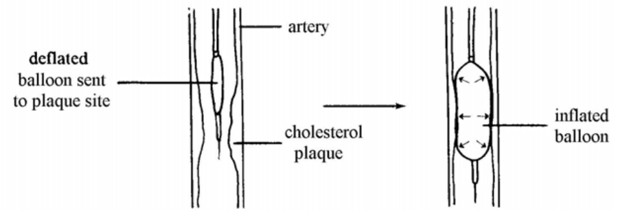 Question figure