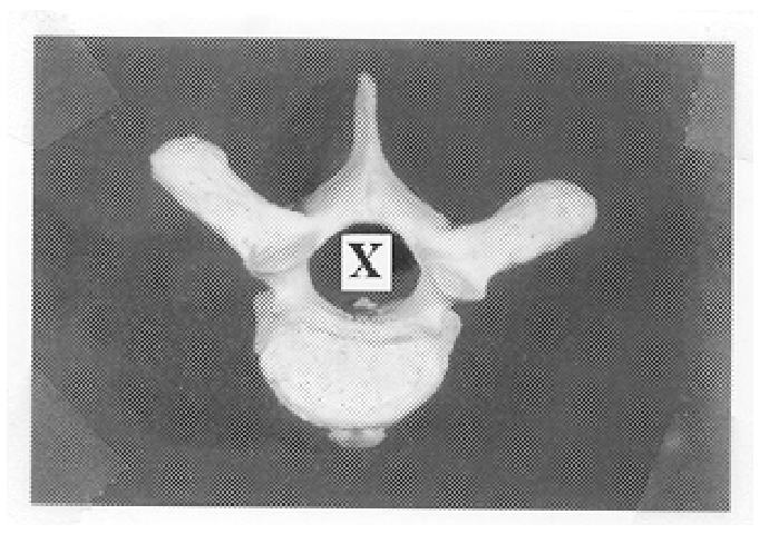 Question figure