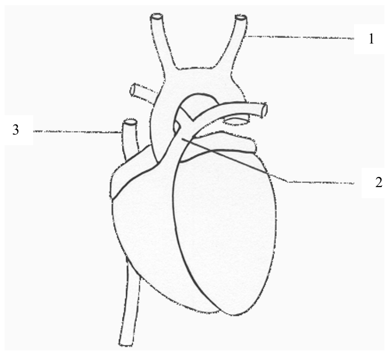 Question figure