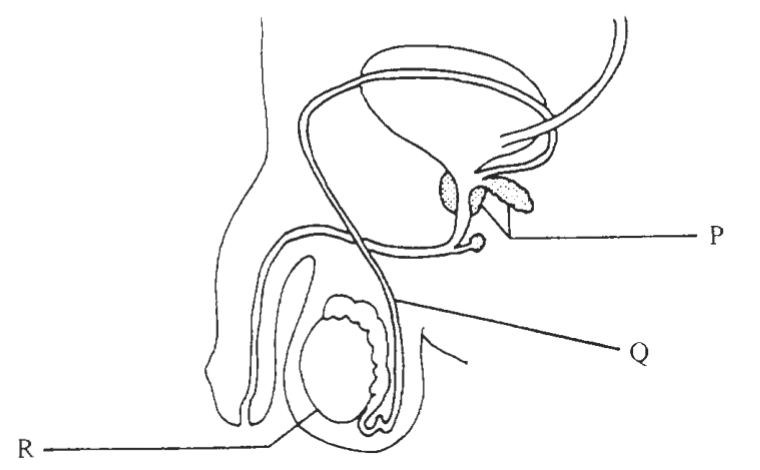 Question figure