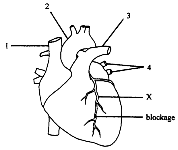 Question figure
