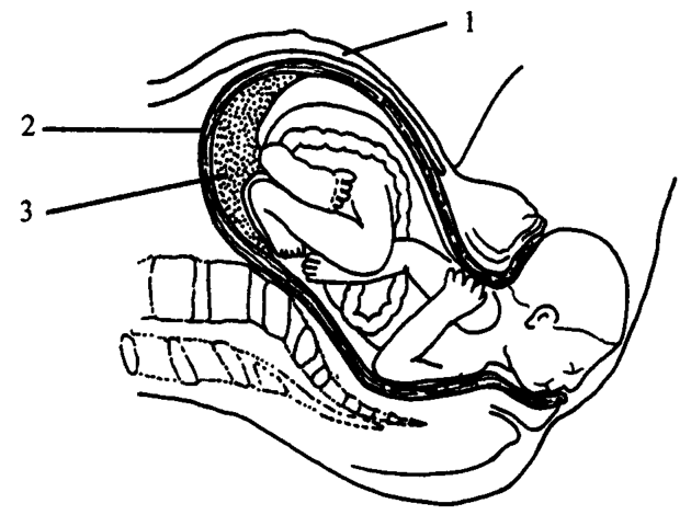 Question figure