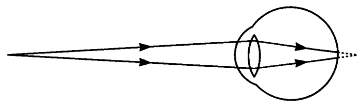 Ray diagram of light entering an eye
