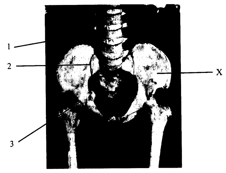 Question figure