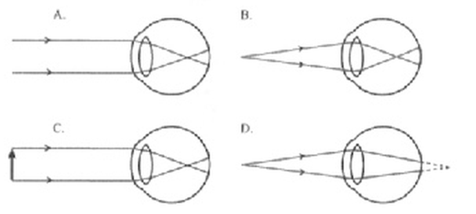 Question figure