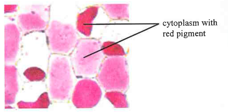 Photomicrograph of epidermal cells with red pigment