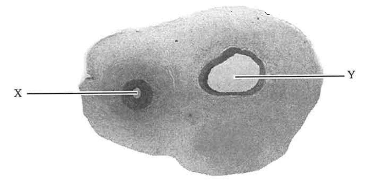 Cross section of the umbilical cord