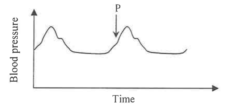 Graph of blood pressure in the aorta against time