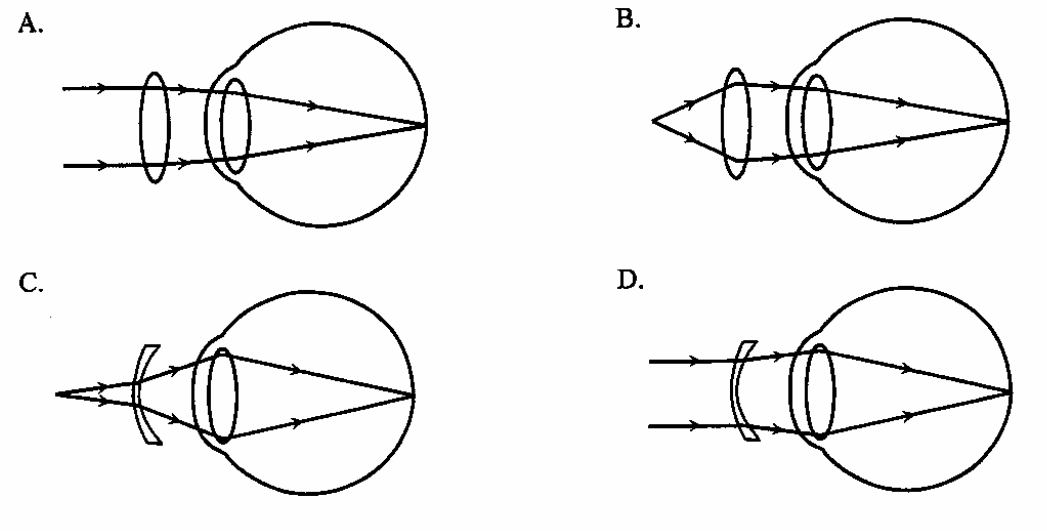 Question figure