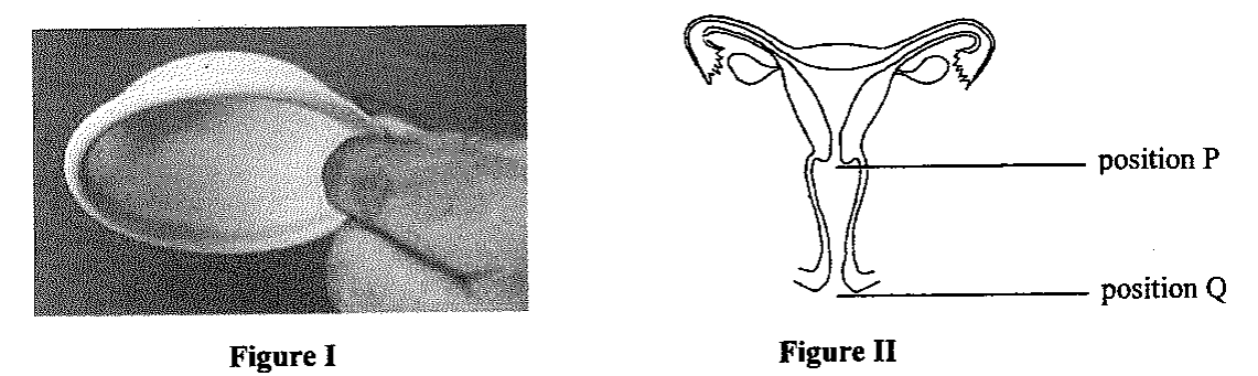 Question figure
