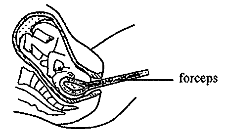 Question figure